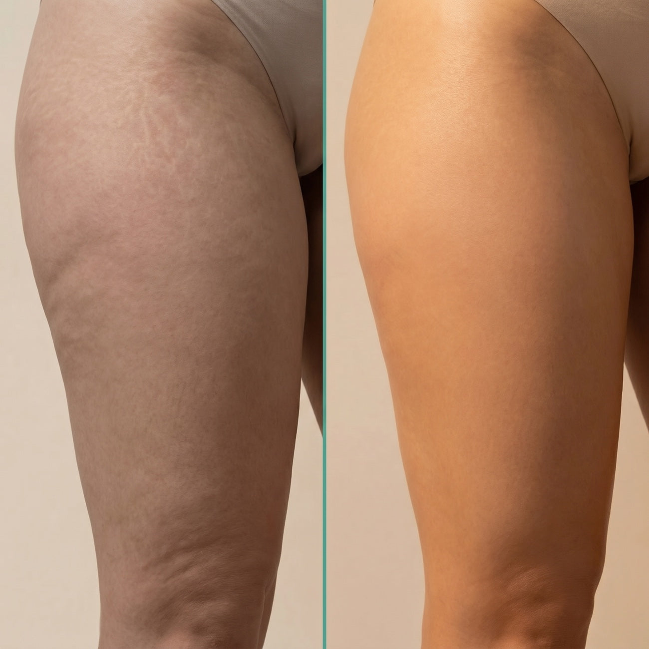 R5_before_after